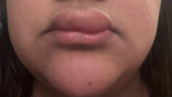 Family Allergy & Asthma Consultants