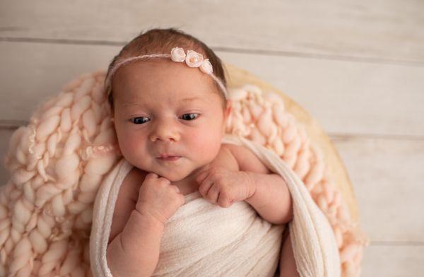 Here, you can see that her left eye is lower than her right. You might also be able to see a flat-ish slope in the left skull above the eye.