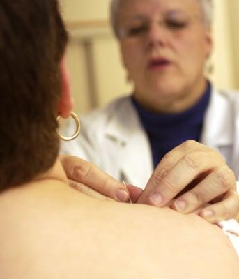 AcupunctureWorks