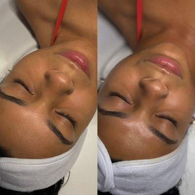 Glass finish facial!