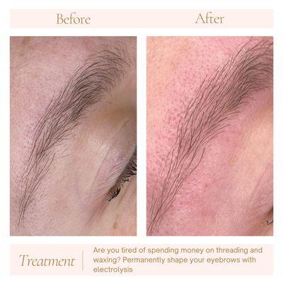 Magnolia Electrolysis