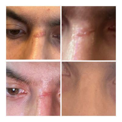 Advanced Dermatology and Laser Institute of Seattle