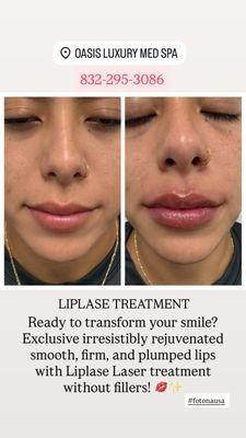 Oasis Luxury Med Spa