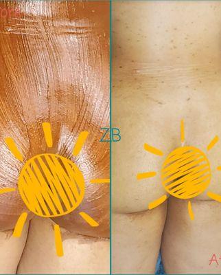 ZL Esthetics