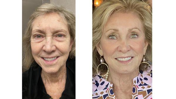 Bafitis Plastic Surgery: Dr. Harold Bafitis