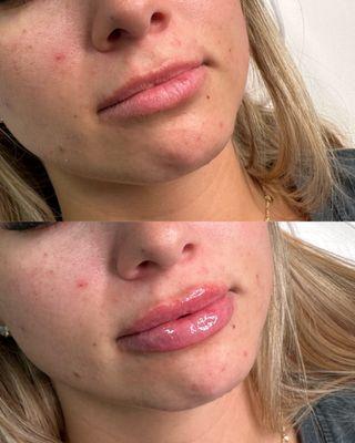 KC Injectables Med Spa