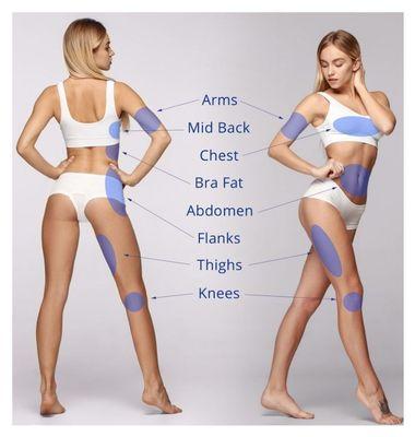 Plasma Skin Tightening - Treated Body Areas