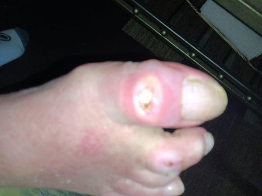 Dr.Blua wanted to schedule an established Diabetic patient in 4 weeks to be seen for THIS!