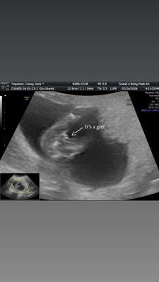 Sneak A Baby Peek 4D