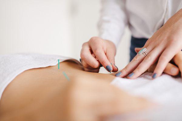 Acupuncture Treatment. Soho Acupuncture By Jen Becker