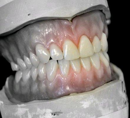 Beckman Digital Dental