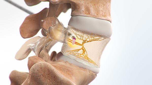 North Shore Pain Management