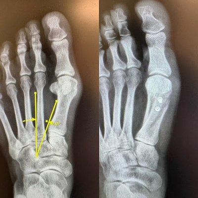 Lakeland Foot and Ankle - Dr. William S Wong, DPM, FACFAS