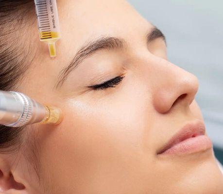 Revitalize your skin with our PRP Microneedling Facial! This innovative treatment uses your body's own healing properties to boost collagen,