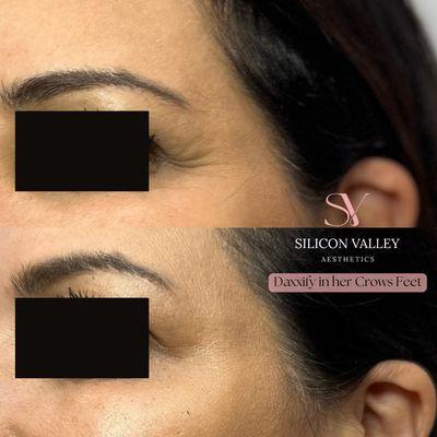 Silicon Valley Aesthetics