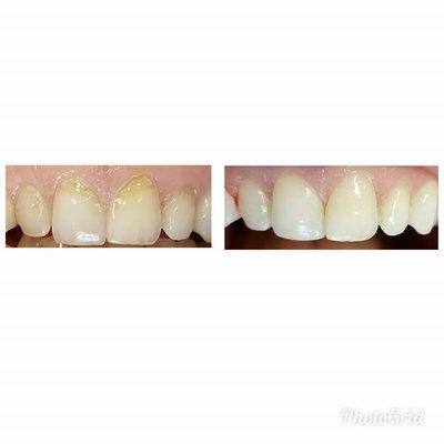 Federal Way Family Dental Care