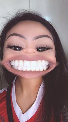 look at what an amazing job Dr. Glady did on my teeth