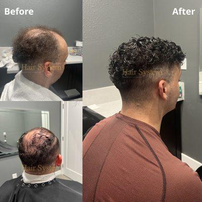 Another Incredible transformation