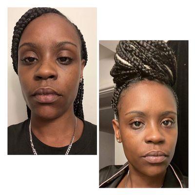 before (left) and after (right) inside beauty mask (product site)