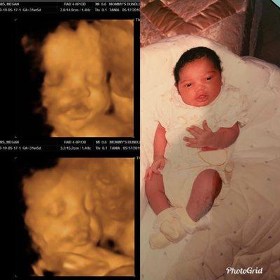 Mommy's Bundle of Joy 4D Ultrasound