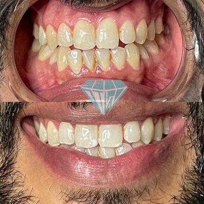 Before and after 1 hour session