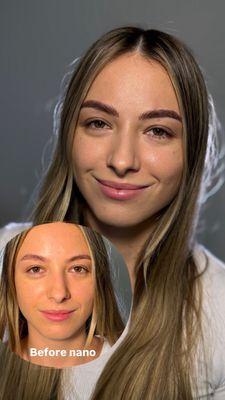 Nano brows