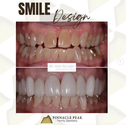 You can count on us to create beautiful smiles!