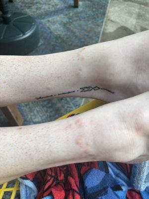 Holiday Inn Express & Suites Cumberland-La Vale By IHG