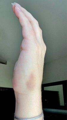 Michael Verdolin, MD