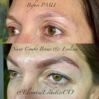 Elevated Esthetics CO