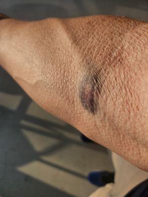 Come on, Quest.  You have to do better than this. It's a simple blood draw at Baptist hospital on Madison Oak , San Antonio.  Ditch digger1