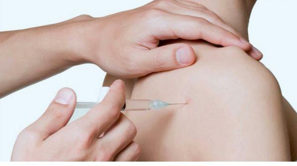 Bio puncture for sports injury , pain management