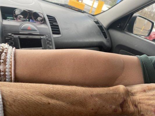 Spray tan tanning bed