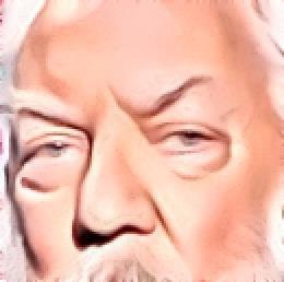 Photo of Ptosis T.