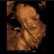 photo of Kimberly V.