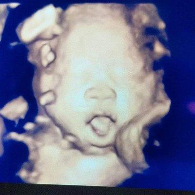 photo of AleliTherese A.