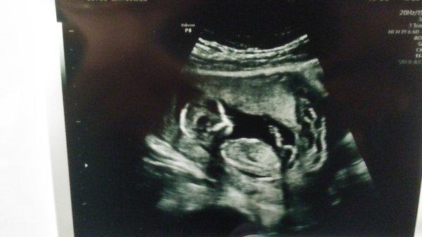 Photo of Brittany H.