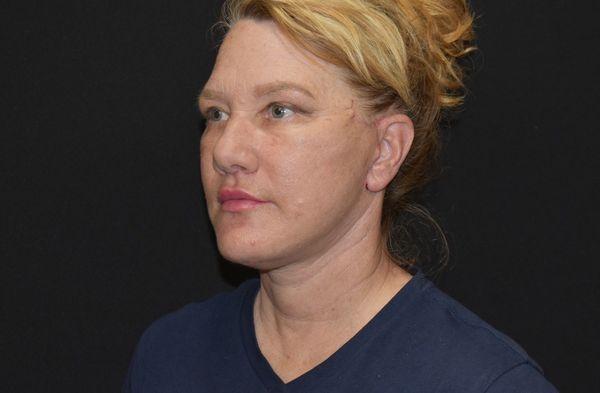 Photo of Cherie V.