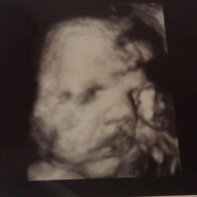 photo of NickandKody L.