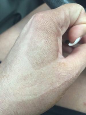 Left my hands looking like this.