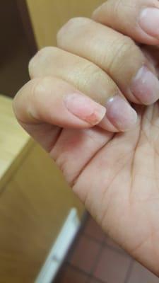 Everlasting Nail