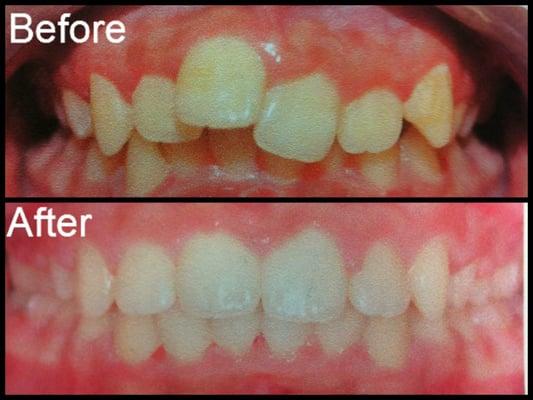 Lone Star Dental and Braces