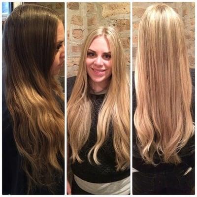 Before and after achieved in one visit.