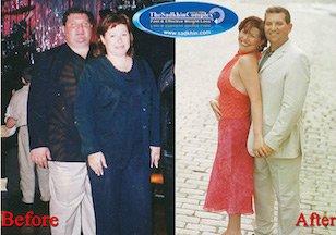 Before and After Shot