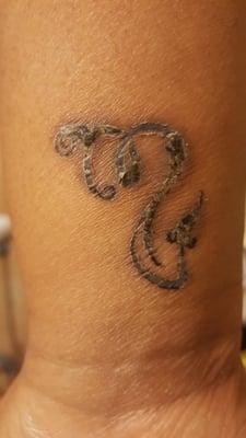 gotten worse now the scabs is coming off and the Tattoo is super ugly looks faded and old only 2 weeks old