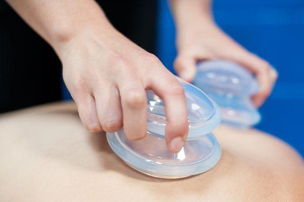 Silicone Cupping