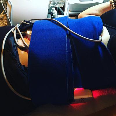 This patient had 1 1/2 inch loss in 2 treatments! Laser Lipo, Cavitation, Radio Frequency