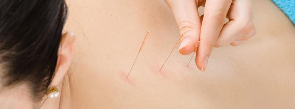 The Acupuncture Center