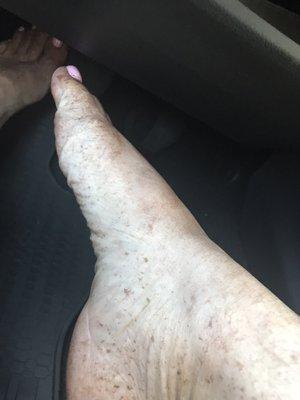 One hour after spray tan