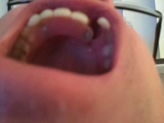 He left me with no teeth !!